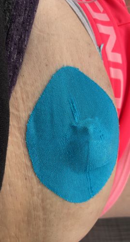 Customer photo review of Skin Grip Medtronic Guardian/Enlite/Libre Adhesive Patches