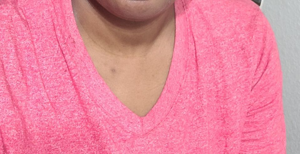 Customer photo review of Fair and White So White! Exfoliating Shower Tonic Scrub 940ml / 31.78 fl oz
