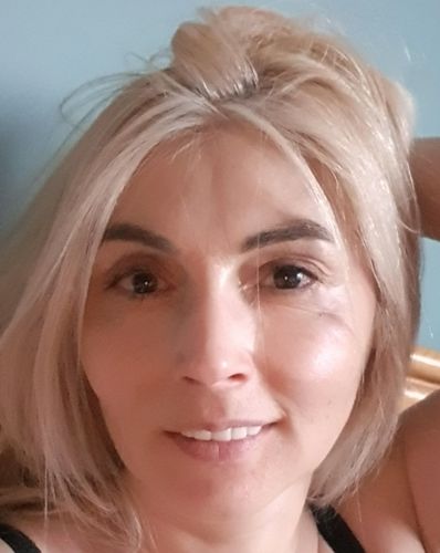 Customer photo review of Tooth-Veneer 2.0