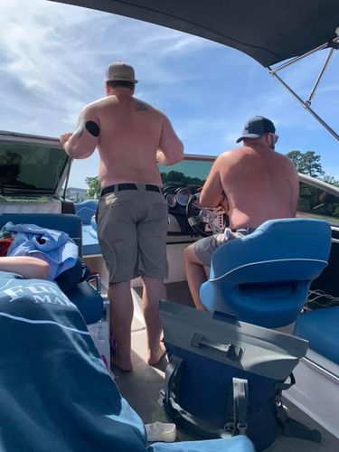 Customer photo review of Skin Grip Freestyle Libre Adhesive Patches