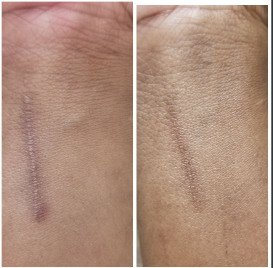 Customer photo review of Magix Cream