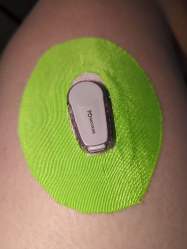 Customer photo review of Skin Grip Dexcom G6 Patches