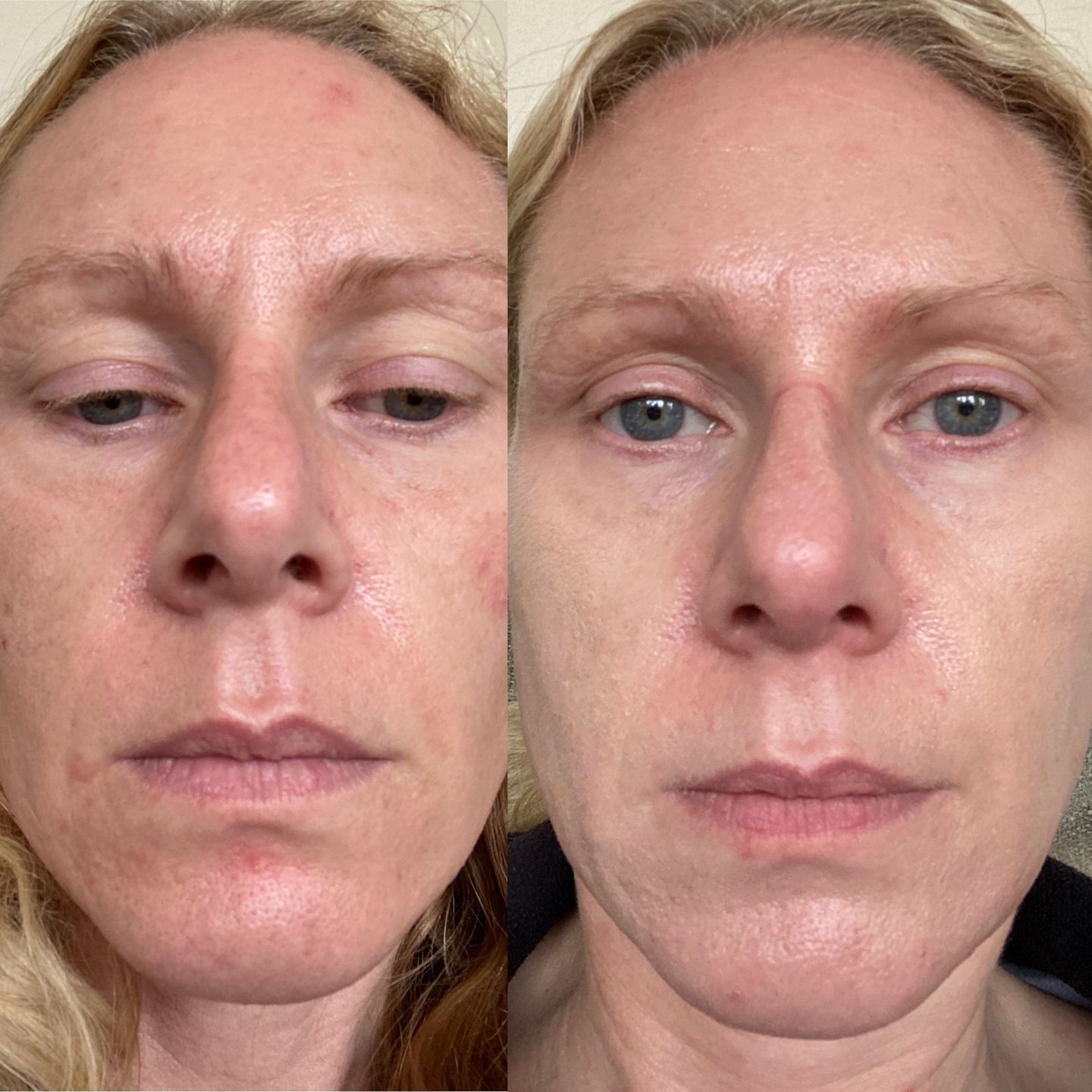 Customer photo review of Cleansing Oil