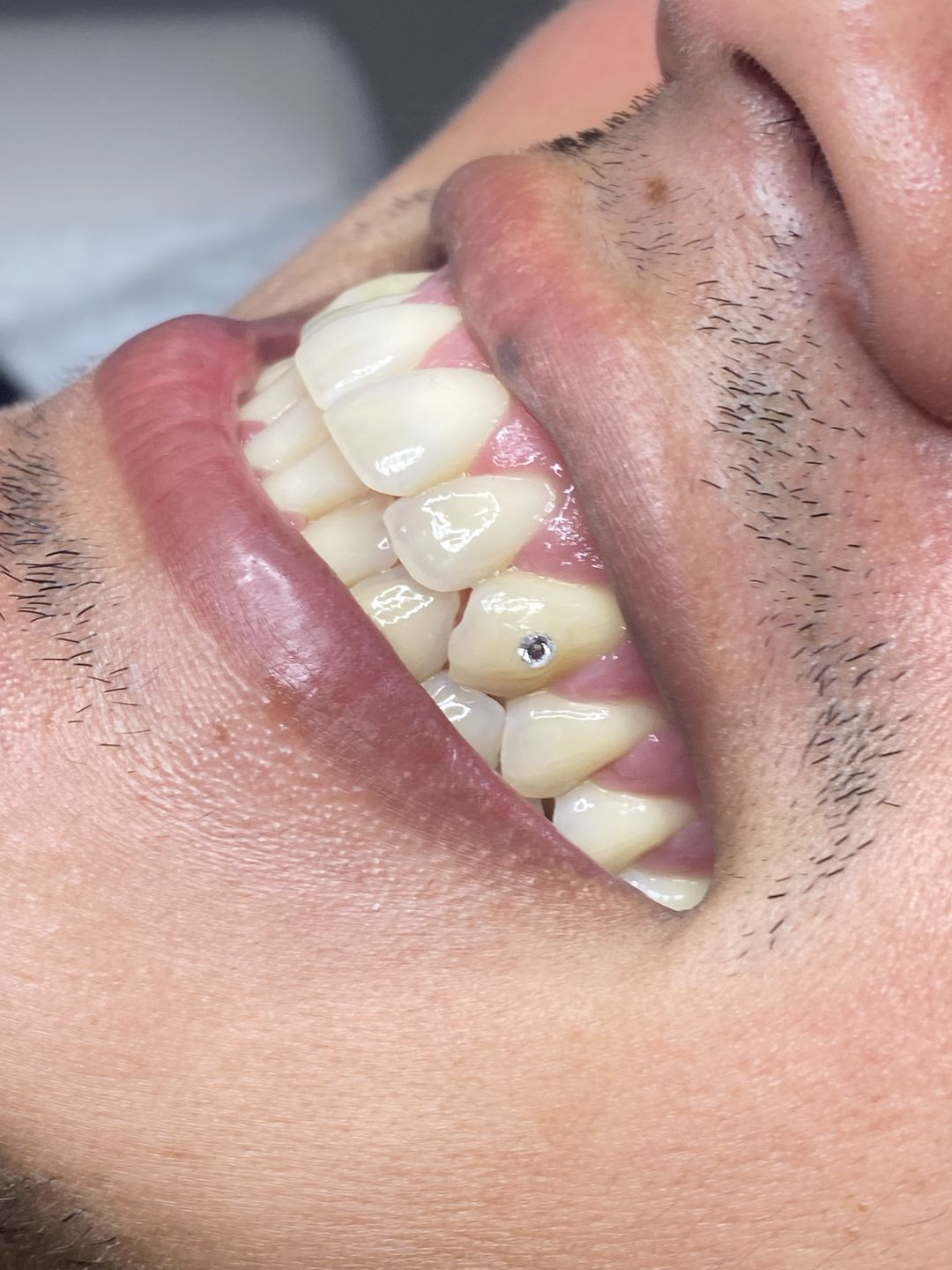 Customer photo review of Crystal Clear 1.8mm 5-pack