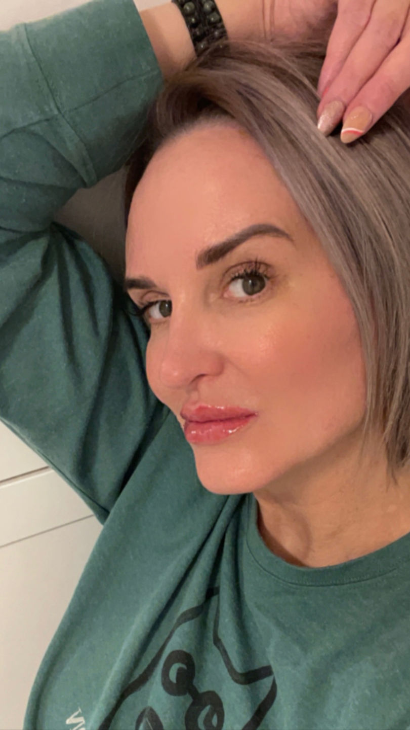 Customer photo review of Anti-Aging Oxygen Serum