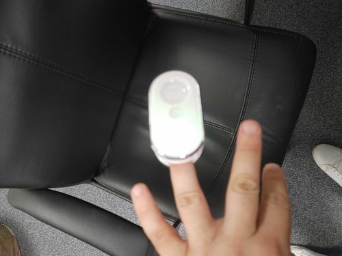 Customer photo review of Onychom - Antifungal Laser Device