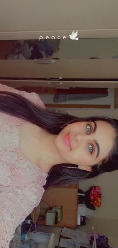 Customer photo review of Citha Hazel Contact Lenses(12 months wear)