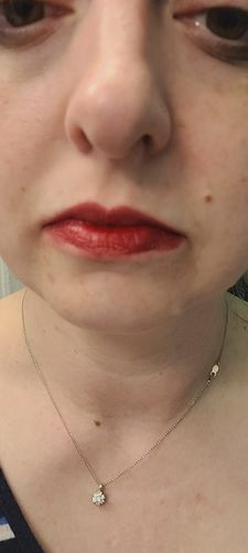 Customer photo review of WONDER BLADING Peel & Reveal Lip Color Kit