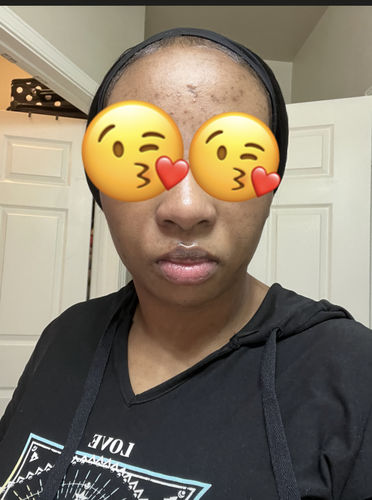 Customer photo review of MINA BRIGHTENING COMBO