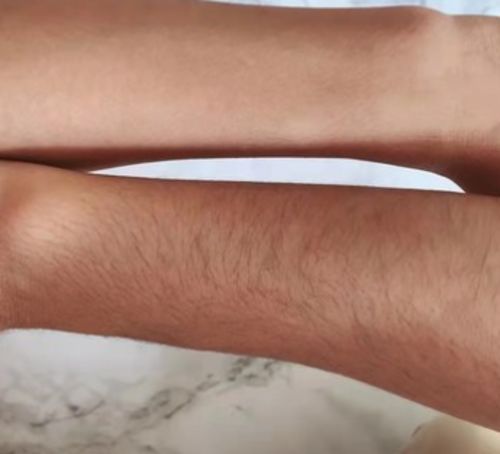 Customer photo review of Belle Body Haarentfernungsschaum