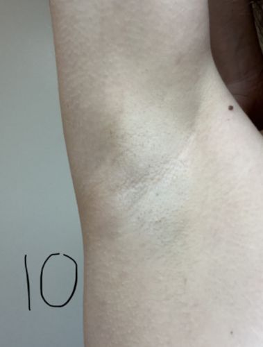 Customer photo review of Belle Body Haarentfernungsschaum