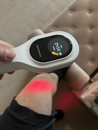 Customer photo review of DERNOX™ Handheld Pain Relief Cold Laser Device