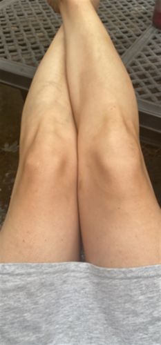 Customer photo review of Belle Body Haarentfernungsschaum