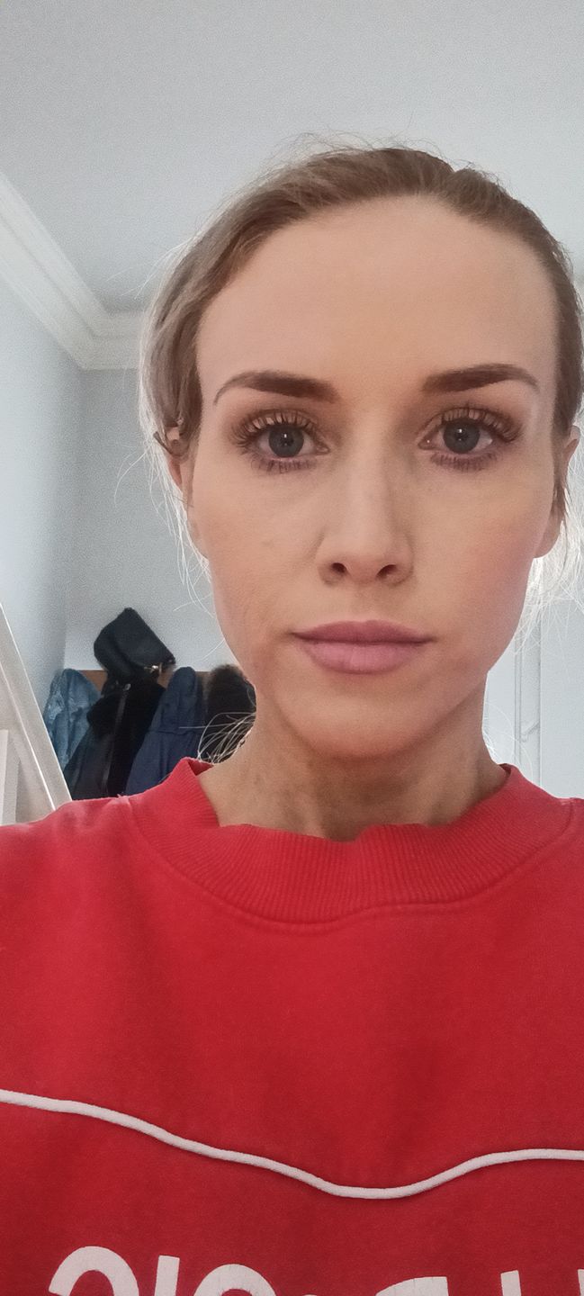 Customer photo review of Healing Miracle Cream