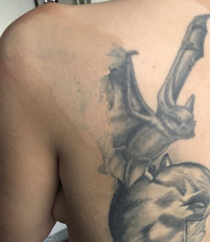 Customer photo review of Maekup Tattoo Cover Gel 30g