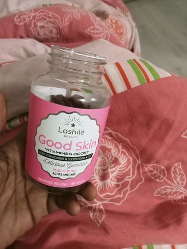 Customer photo review of Good Skin Vitamins - 6 mois
