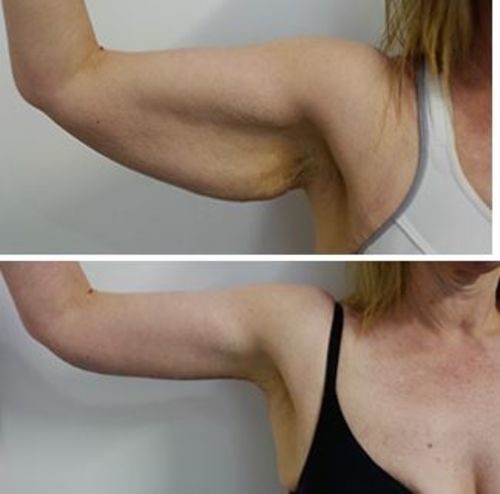 Customer photo review of Triple Weight Loss Chakra Power Bracelet