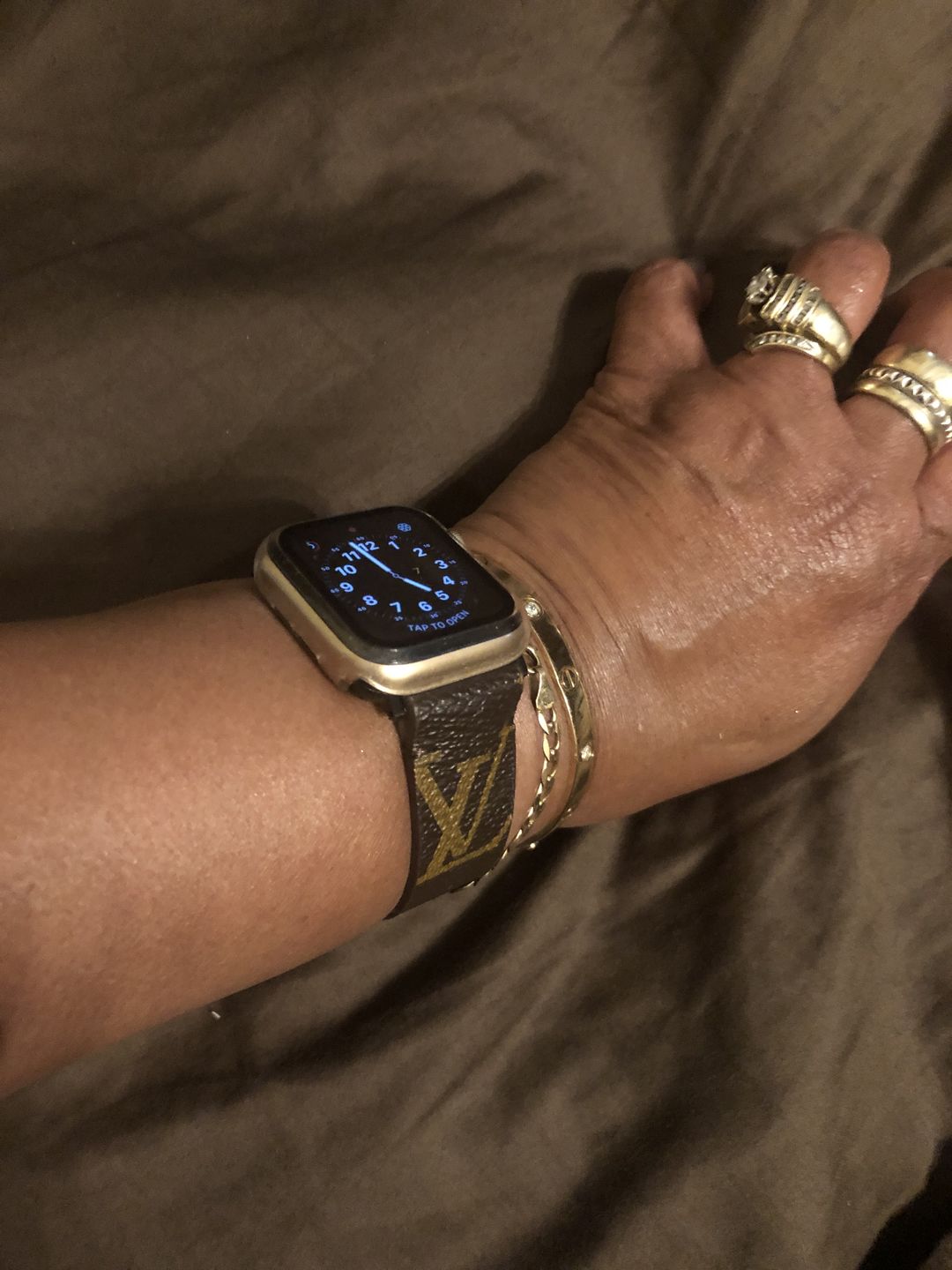 Customer photo review of Apple Watch Band Classic LV Monogram
