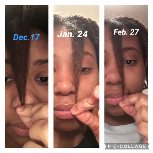 Customer photo review of Rice Water Scalp Mist (PreMade)