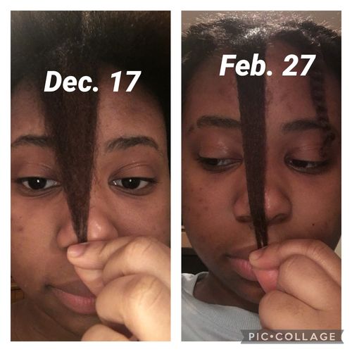Customer photo review of Rice Water Hair Growth Kit
