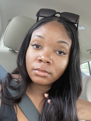 Customer photo review of BERRI-CLEAR+ 5 BERRY SUPERFRUIT SERUM