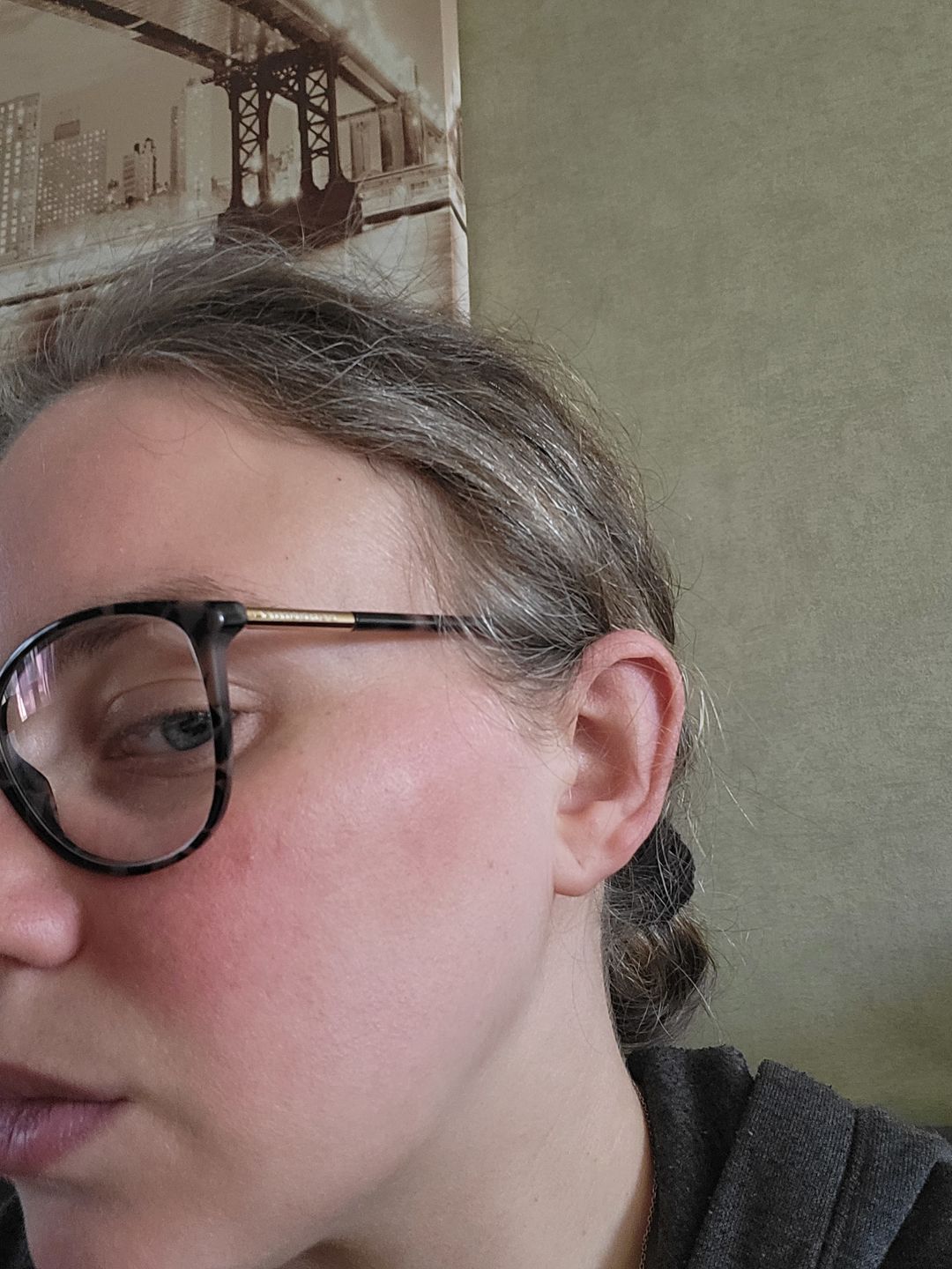 Customer photo review of Good Skin - 3 mois