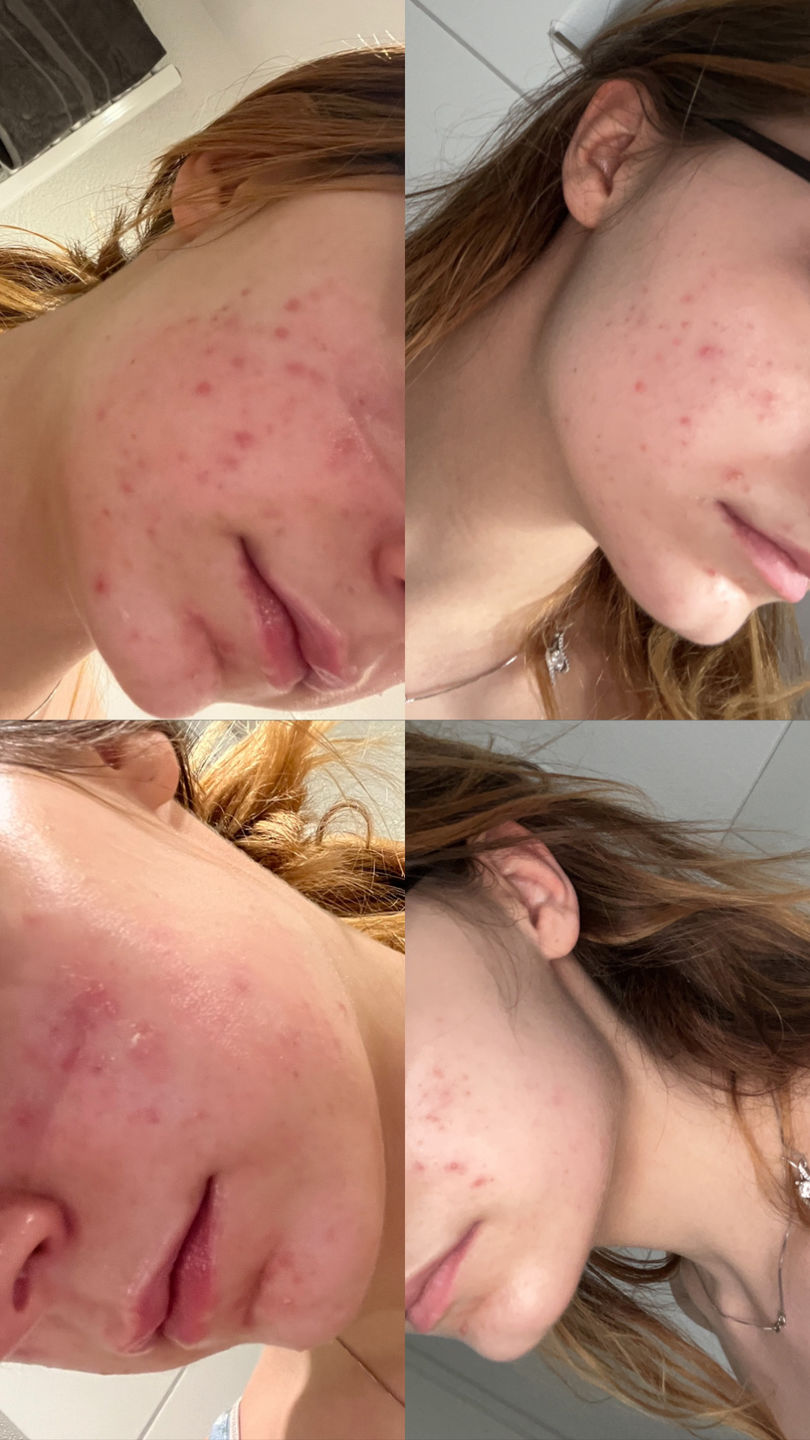 Customer photo review of Sleek Skin Serum 30ml