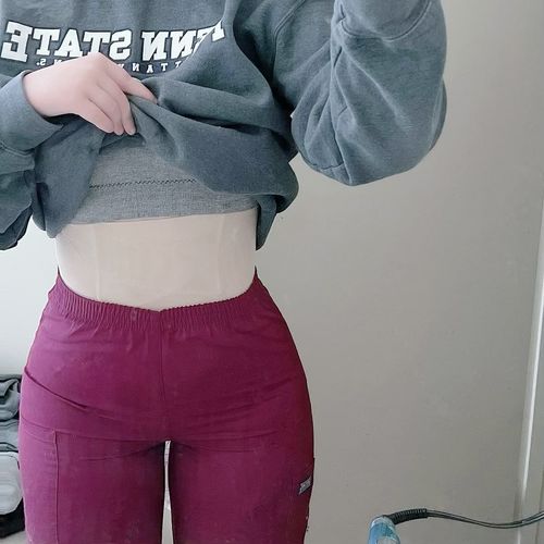 Customer photo review of SuperShaper™