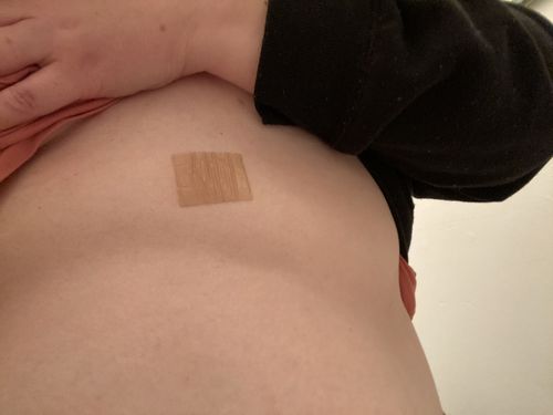 Customer photo review of Ultimate Mood Patch - 4 week Supply