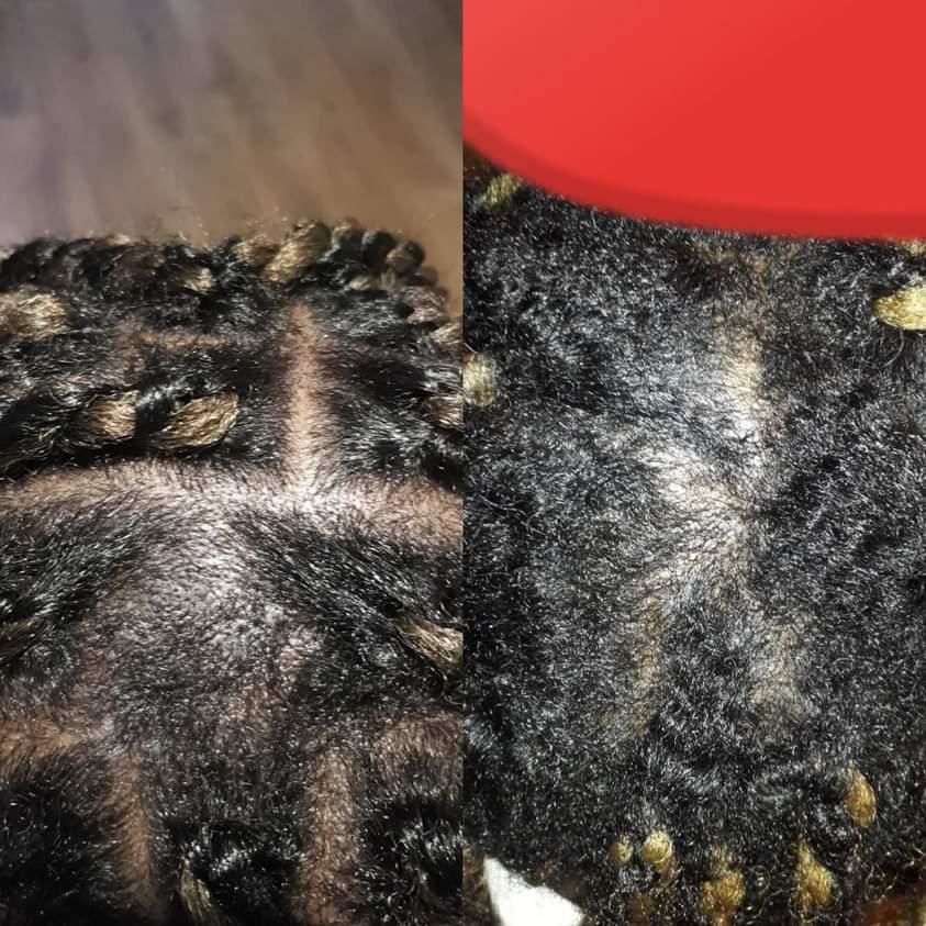 Customer photo review of Herbal Growth Oil