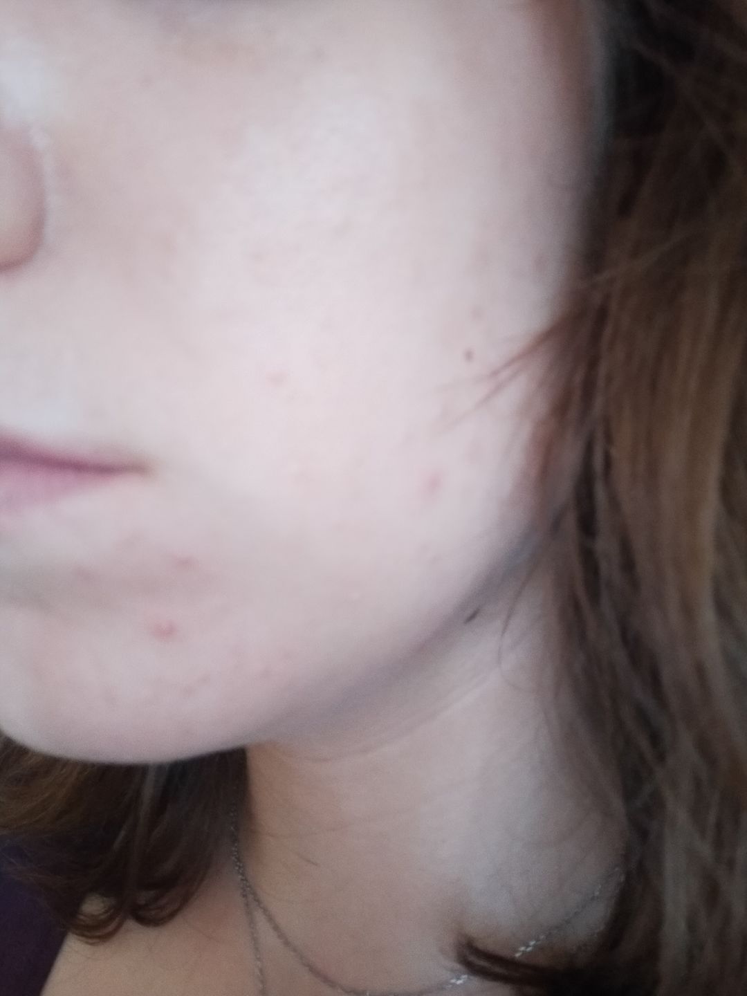Customer photo review of Good Detox - 1 mois