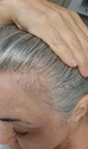Customer photo review of HariPure ReGrowth Centella Purifying Scrub