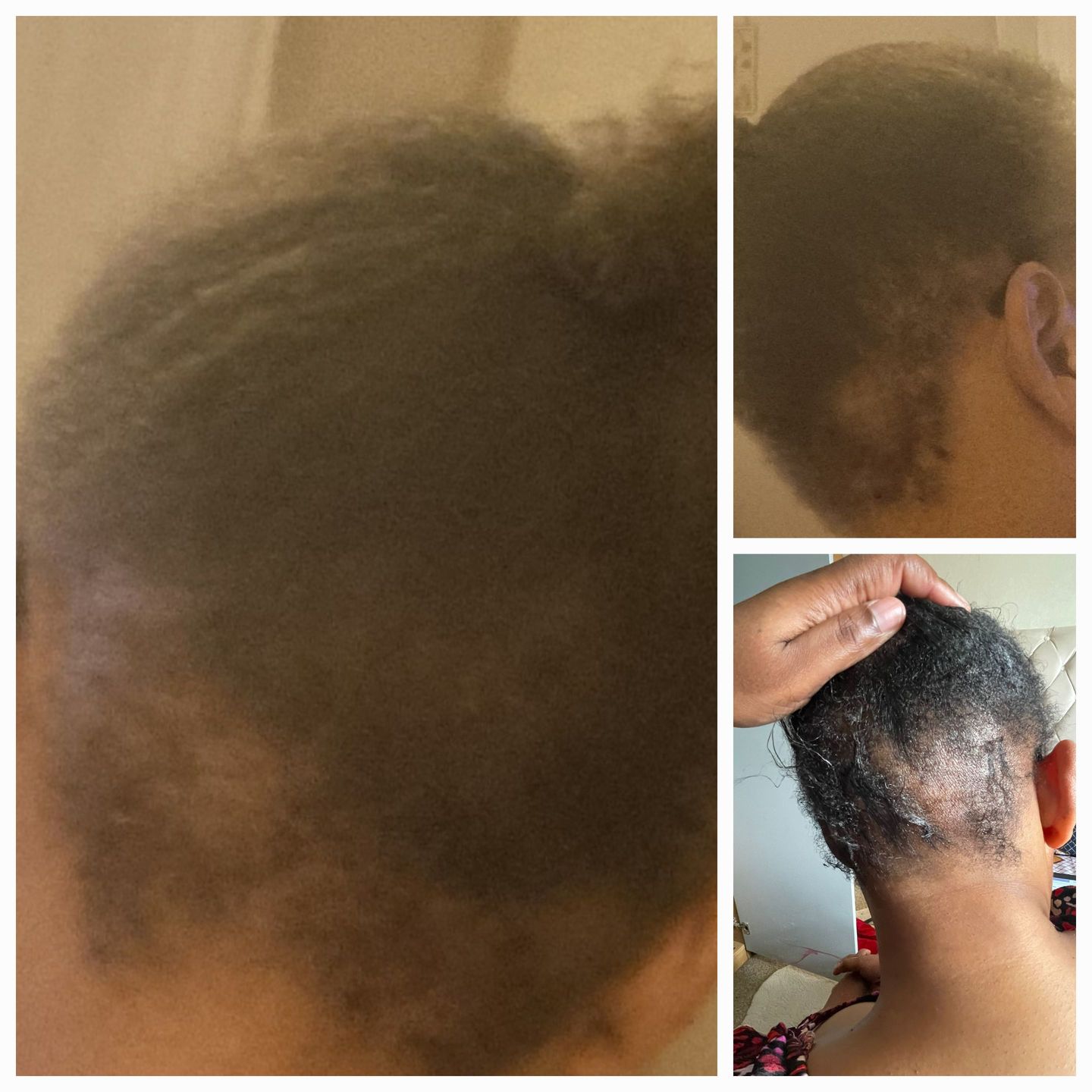 Customer photo review of Miracle Hair Bundle