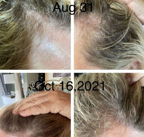 Customer photo review of HariPure ReGrowth Centella Purifying Scrub
