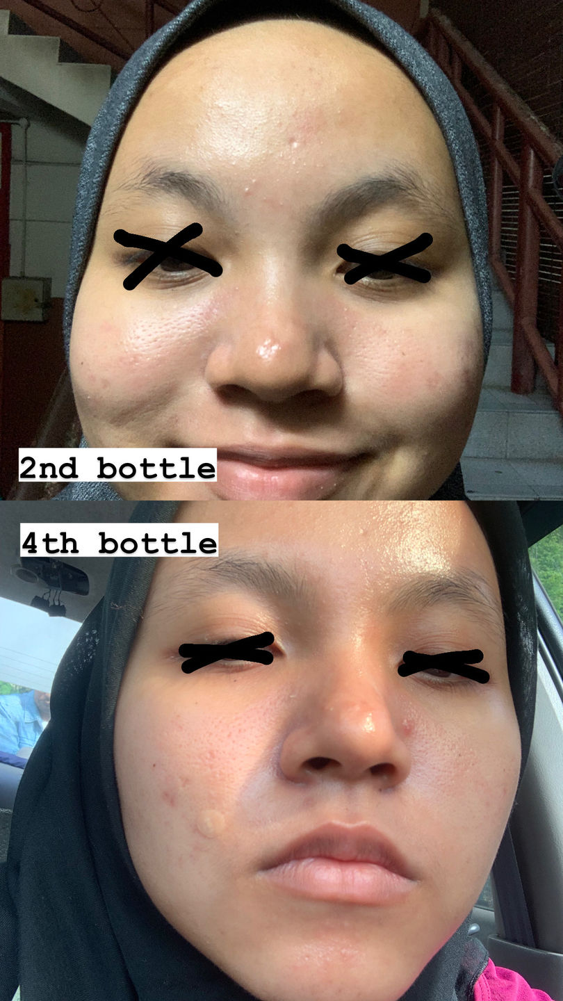 Customer photo review of Face Set