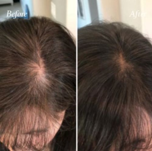 Customer photo review of HariPure ReGrowth Centella Purifying Scrub