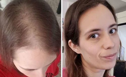 Customer photo review of HariPure ReGrowth Centella Purifying Scrub