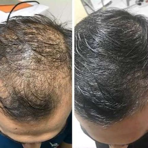 Customer photo review of HariPure ReGrowth Centella Purifying Scrub