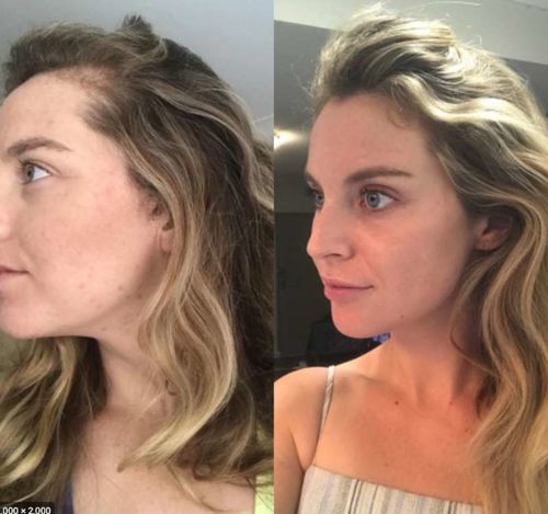 Customer photo review of HariPure ReGrowth Centella Purifying Scrub