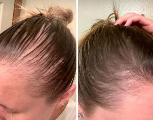 Customer photo review of HariPure ReGrowth Centella Purifying Scrub