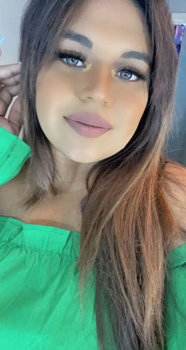 Customer photo review of Dawn Blue Colored Contact Lenses