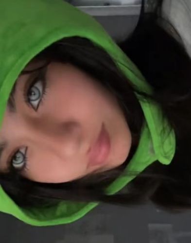 Customer photo review of Himalaya Blue Contact Lenses(12 months of use)