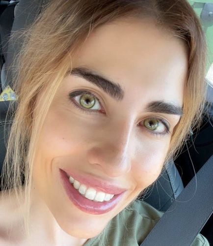 Customer photo review of Dawn Green Colored Contact Lenses