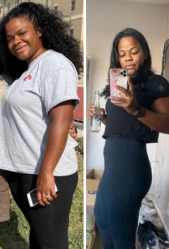 Customer photo review of Perfect Detox Slimming Patch(Limited Time Discount 🔥 Last Day)