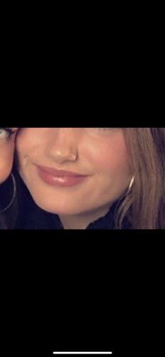 Customer photo review of LipFix: LipFlip