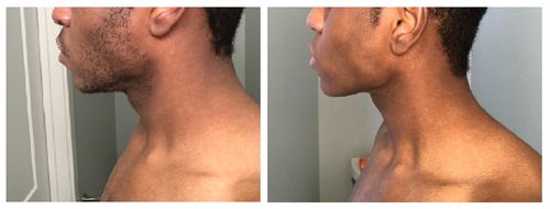 Customer photo review of SnabbRakare™