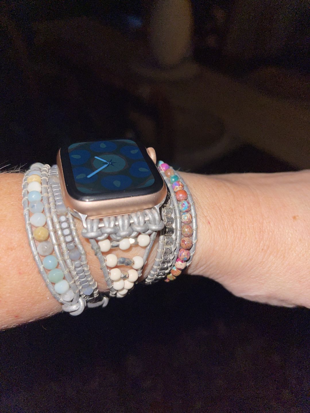 Customer photo review of Healing Turquoise Protection Apple Watch Strap