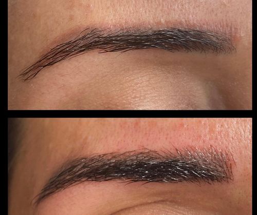 Customer photo review of Scalpa Numb - Pre Procedure