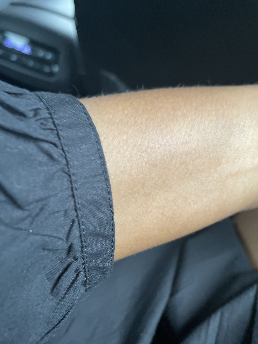 Customer photo review of Fair and White So White Skin Perfector Serum 30ml / 1 fl oz