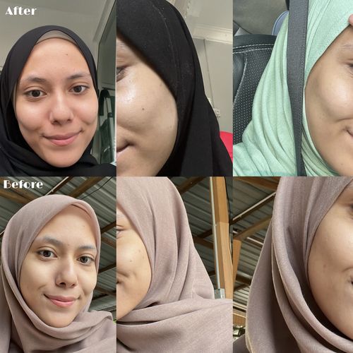 Customer photo review of Brightening Face Creme